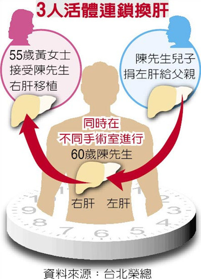 全臺(tái)首例臺(tái)北榮總醫(yī)院完成“3人活體連鎖換肝”